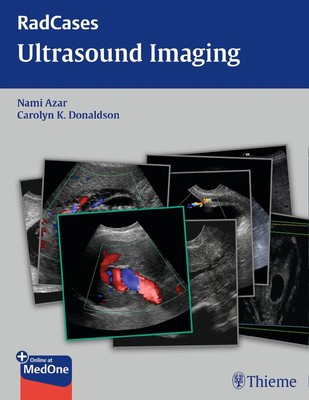 Radcases Ultrasound Imaging | Nami R Azar (u. a.) | Englisch | Taschenbuch