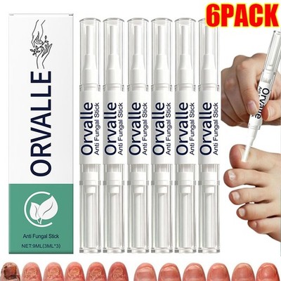 Orville Anti Fungal Pen Intensive Treatment Toenail Fungus Foot Nail Repair Oil