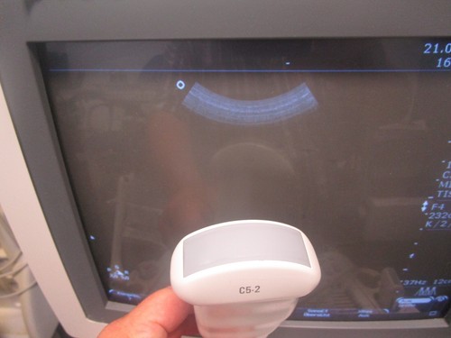 Philips C5-2 Ultrasound Probe transducer 21426A Konvex Sonde Ultraschallsonde - Picture 4 of 4