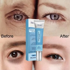 Instant Remove Wrinkle Eye Cream Eye Bags Dark Circles Anti Puffiness Firm Serum