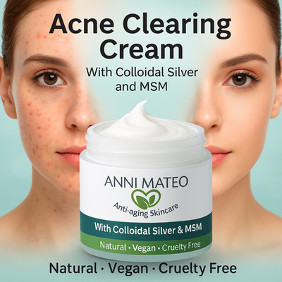 Acne Clearing Cream with Colloidal Silver and MSM - Natural, Vegan, Cruelty Free