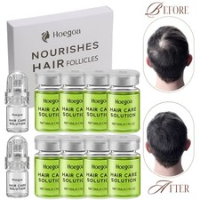 8Pcs/SET MICRONEEDLE Hair Regrowth System, Advanced Hair Treatment Ginseng Serum