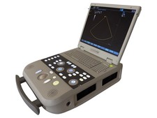 Siemens Acuson P300 Portable Ultrasound Machine System DICOM Cardiac MSK OB/GYN
