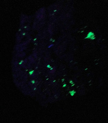 Erythrin xx etc : Schmiedestollenhalde, Wittichen, Schwarzwald - Bild 5 von 6