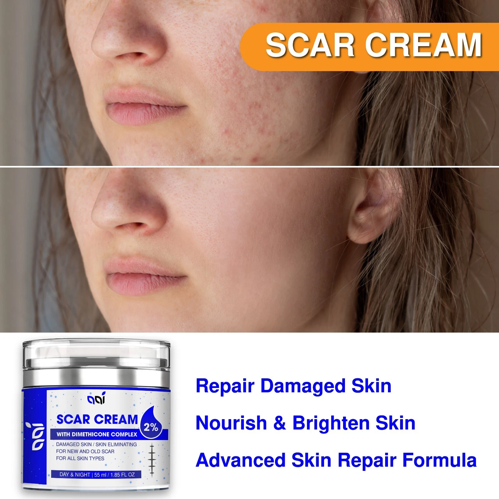 Scar Reducer Stretches Mark Cream Scar Away Old and New Scars For Men & Women Cream