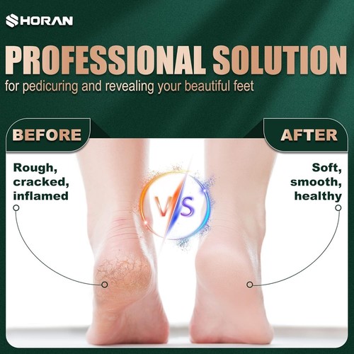 Professional Electric Callus Remover - 2 Speed Pedicure Tool with LED Display - Picture 4 of 13