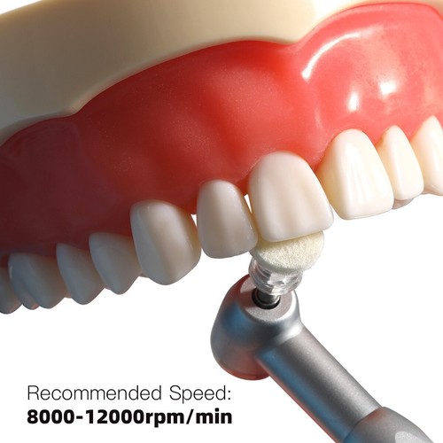 Kit de Discos de Pulido de Pasta de Composite Dental 50Pcs Discos Desechables - 第 14/20 張圖片