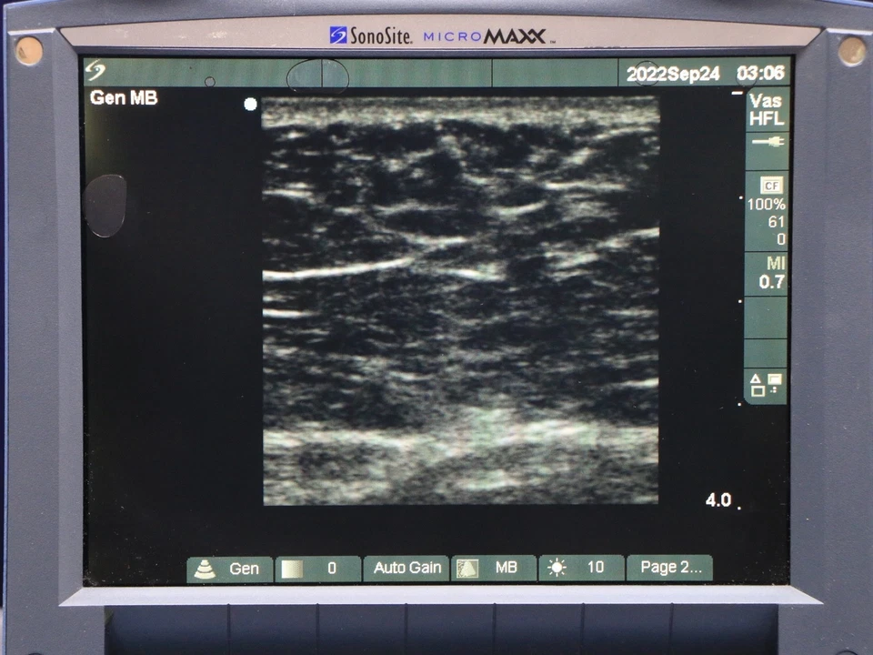 Sistema de ultrassom SonoSite MicroMaxx com sonda - Imagem 2 de 4