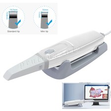Digital Intraoral Dental Scanner Scan 33