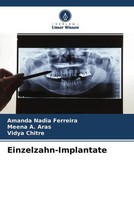 Einzelzahn-Implantate Amanda Nadia Ferreira (U. A.) Taschenbuch 108 S. Deutsch
