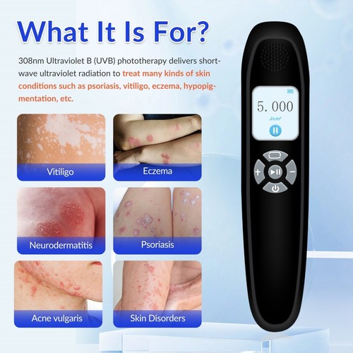 308nm 65mW/cm² Home Therapy Machine Psoriasis Eczema UVB Light Treatment Device - Picture 3 of 8