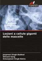 Lesioni A Cellule Giganti Delle Mascelle Jaspreet Singh Badwal (U. A.) Buch 2024