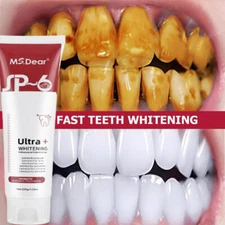 Dual-Action SP-6 Probiotics Whitening Toothpaste-Brightening & Fights Bad Breath