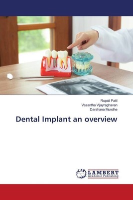 Rupali Patil (u. a.) | Dental Implant an overview | Taschenbuch | Englisch