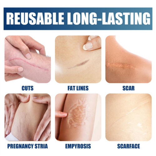 NEW Scar Removal Cream Gel Surgery Skin Care Repair Scar Gel Skin Repair Cream ~ - Picture 2 of 10