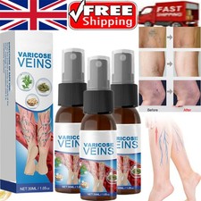 3 Pack Varicose Veins Spray Veins Treatment Spray for Legs Natural herbal 30ml