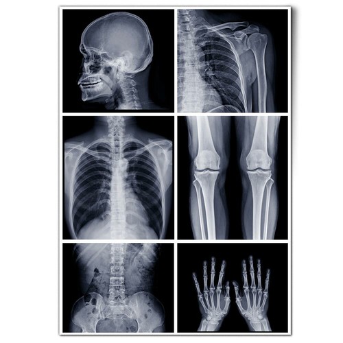 A1 - Radiology Doctor Hospital X-Ray Science Poster 59.4x84.1cm180gsm Print #244