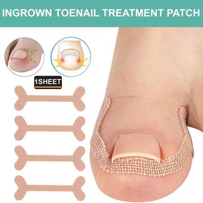 PEDIMEND  Zehennagelkorrektur Aufkleber Paronychie eingewachsen Glättung 1 Patch UK