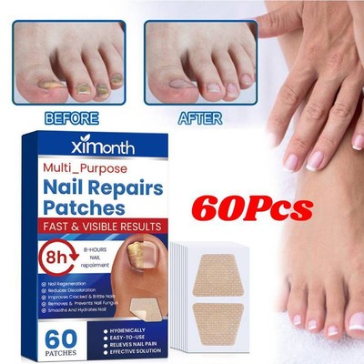 60Pcs Toenail Fungus Treatment Sticker Nail Repair Patches Treat ment Tool Kit