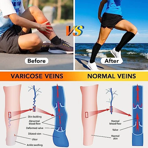 Pair Medical Compression Socks Varicose Knee Vein Open Toe Support Stockings - Bild 11 von 50