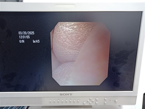OLYMPUS GIF-160 VIDEO GASTROSCOPE W/ CARRYNG CASE - Picture 5 of 8