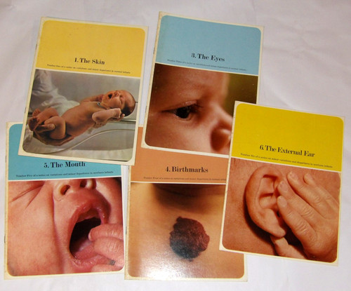 5 VTG 1969-70 BOOKLETS! MINOR VARIATIONS & DEPARTURES IN NEWBORN INFANTS! EYES++