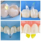 Clear Matrix Dental Anterior Matrices Posterior Class II Fit BioClear Fit Biofit