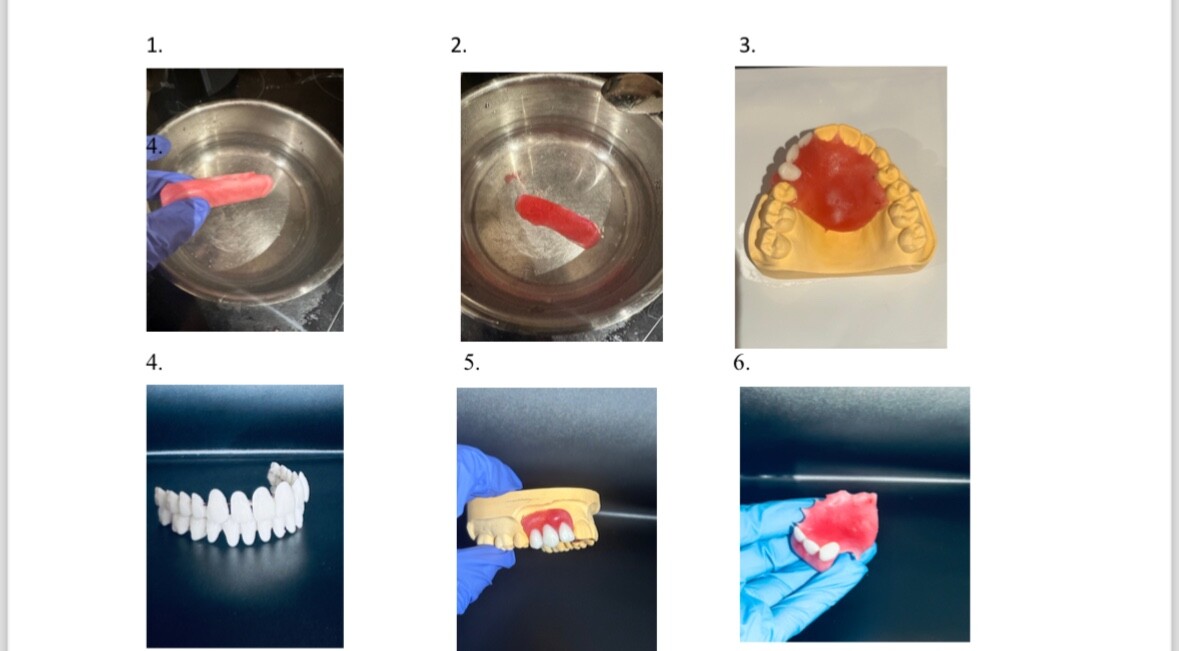 DIY Reparatur-Set Für Prothesen & Gebisse – Temporäres Reliner-Kit, Rosa, Aus Deutschland