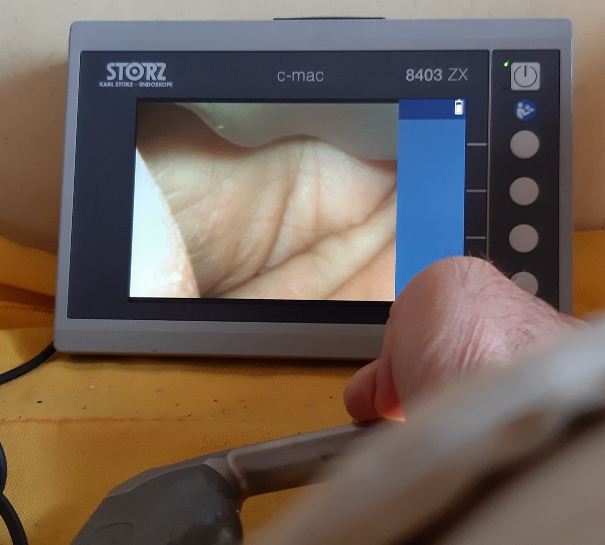 スキャナー Karl Storz 8403 ZX C-MAC Endoscope, 8402 XS Imager, 8401 YZ