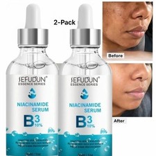 2-pk Niacinamide B3 Face Serum Brightening Skin Anti Dullness, 30ml  USA Stock 