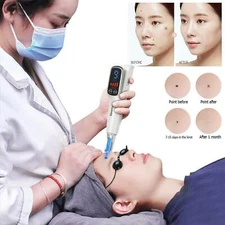 Handheld Picosecond Laser Freckle Removal Pen Tattoo Machine Blue LED Light