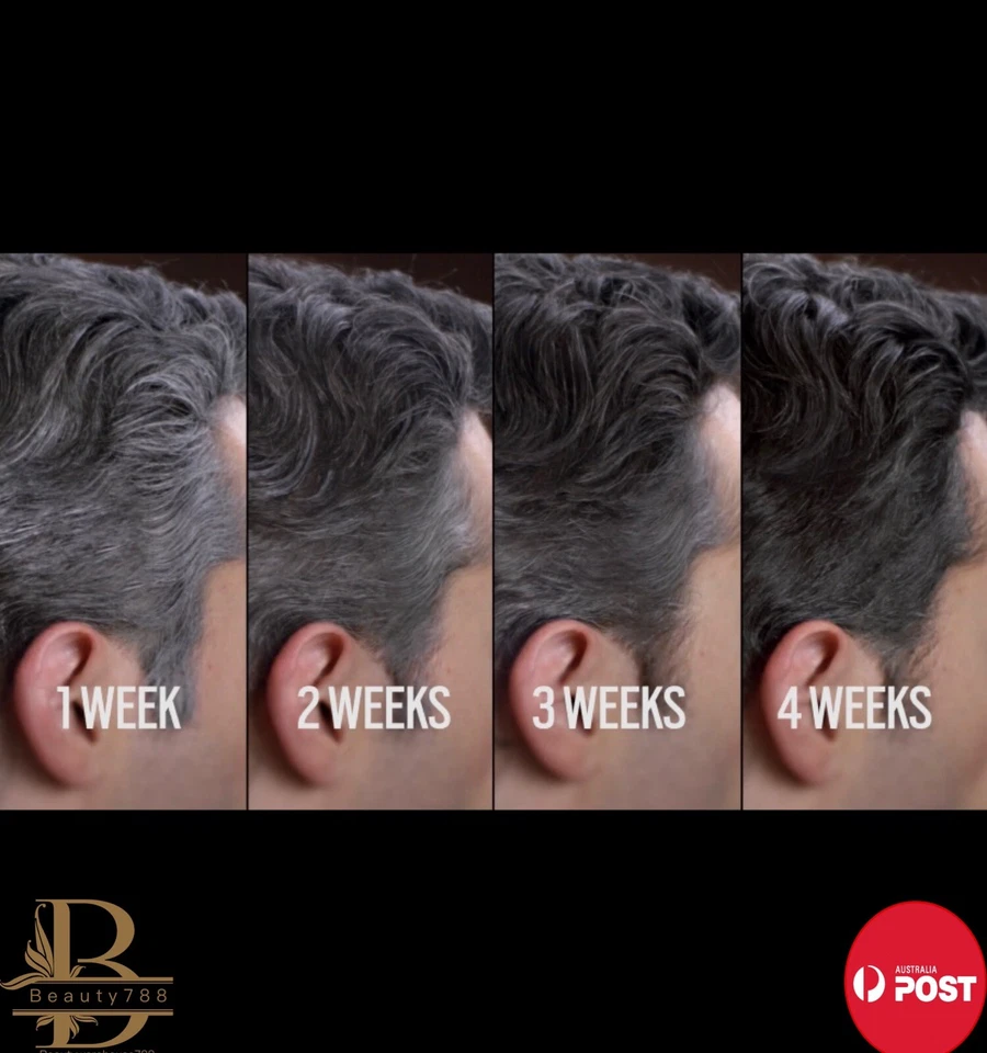 Restoria Discreet hair colour Restoring Lotion 236ml Hair Colour Restoria new - image 3 of 4