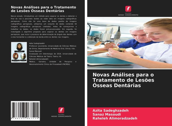 Novas AnáLises Para O Tratamento De LesõEs ÓSseas DentáRias Azita Sadeghzadeh-image