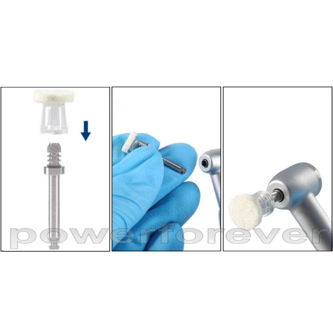 Shofu Style Dental Super Buff Polishing Disks - Composite Resin Polisher Snap Discs