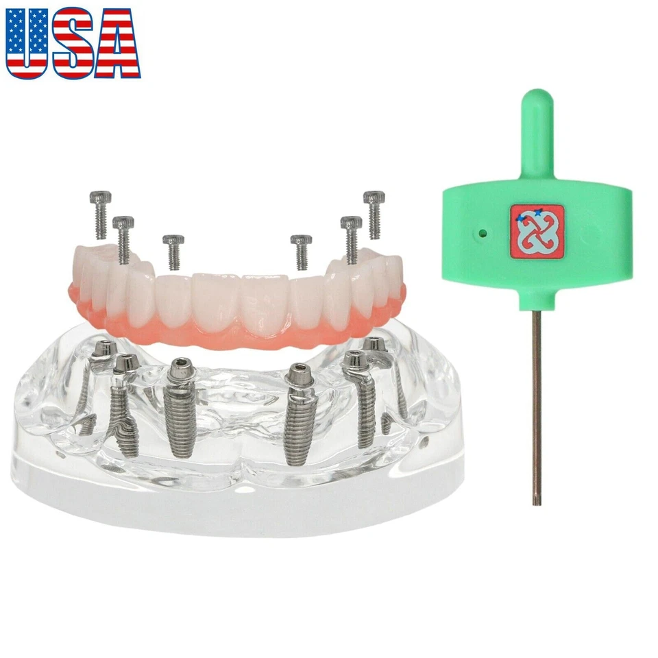 US Dental Overdenture Restoration Teeth Model Upper/Lower Jaw Type With 4/6Screw - Image 4 of 4