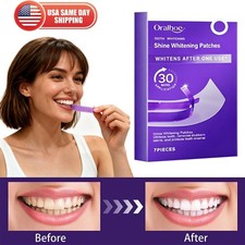 Purple Teeth Whitening Strips Brighten Tooth Remove Plaque Stain Cleaning Oral