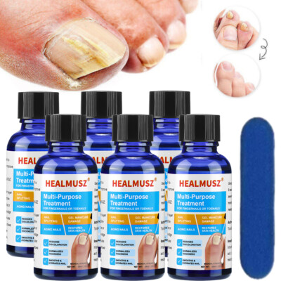 5/3PCS Fungal Nail Renewal Treatment, Toe Fungus Onychomycosis Repair Serum Oil