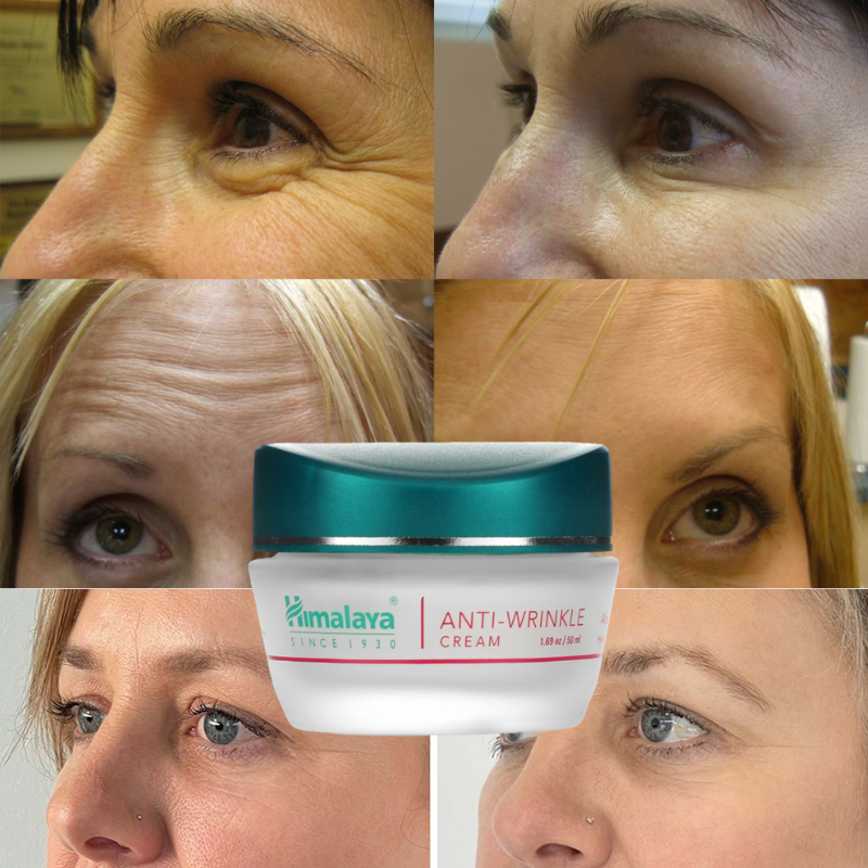 Hemalaya Herbals Anti Wrinkle And Fine Lines Cream For Normal To Dry Skin 50g