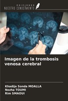 Khadija Sonda Moalla (U. A.) | Imagen De La Trombosis Venosa Cerebral | Buch
