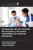 Mohamed Wakwak (U. A.) | EvaluacióN De Las Coronas De Zirconio Y De Acero...