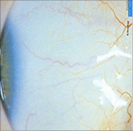 Минус Халльдор Лакснесс (CD)