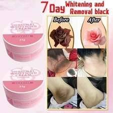 Whitening Cream Skin White Fade Super Brightening Dark Spot All Skin Type 25g