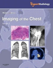 Imaging of the Chest, 2-Volume Set: Expert Radiology Series by