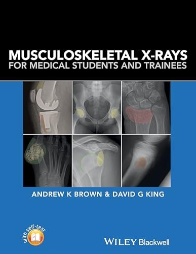Musculoskeletal X–rays for Medical Students Brown Paperback Wiley–Blackwell - Image 10