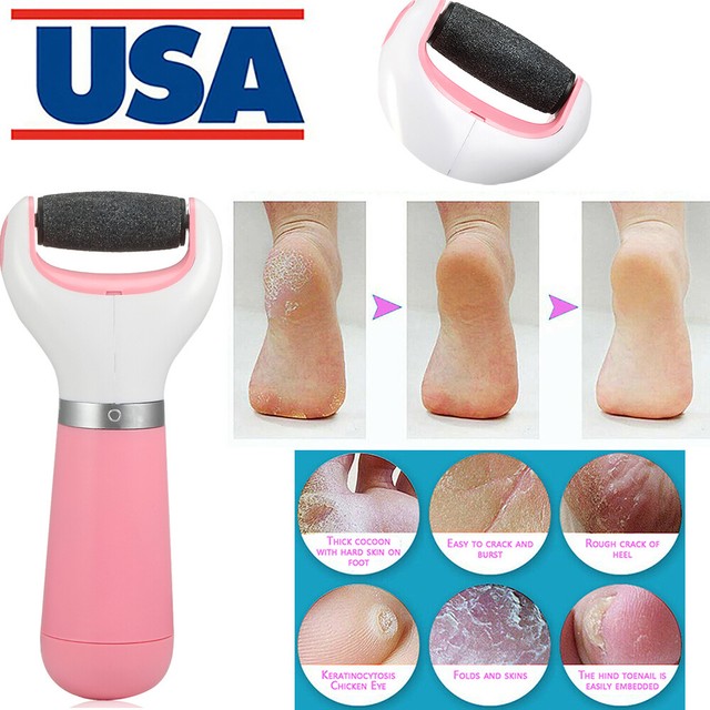 Electric Callus Remover Cordless Foot Skin Care Pedicure Battery Foot