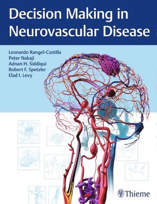 Decision Making in Neurovascular Disease | englisch