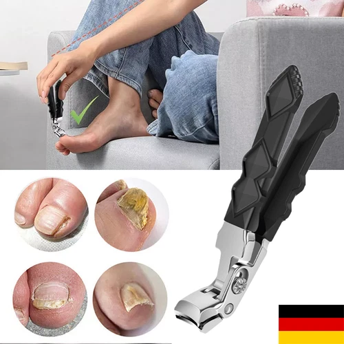 Nagelknipser Groß für Dicke Nägel Fußnagelknipser Nagelschneider Nagelzwicker DE - Bild 2 von 20