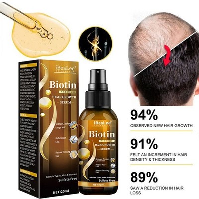 3PCS Biotin Hair Growth Spray Anti Hair Loss Fast Regrowth Scalp Treatment Serum