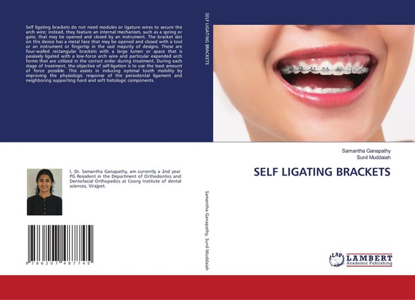 Samantha Ganapathy (U. A.) | Self Ligating Brackets | Taschenbuch | Englisch-image