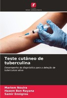 Teste CutâNeo De Tuberculina Mariem Nouira